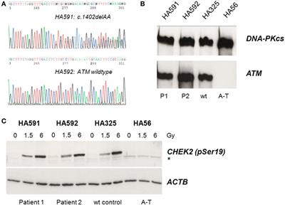 Clinical and Biological Manifestation of RNF168 Deficiency in Two Polish Siblings